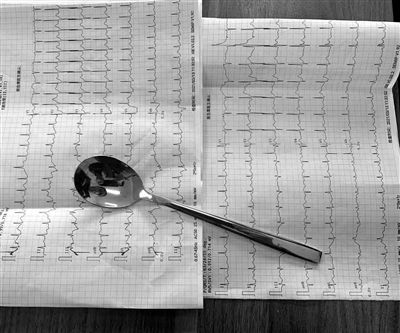 “别慌，拿把汤勺来”医生用这招救其一命